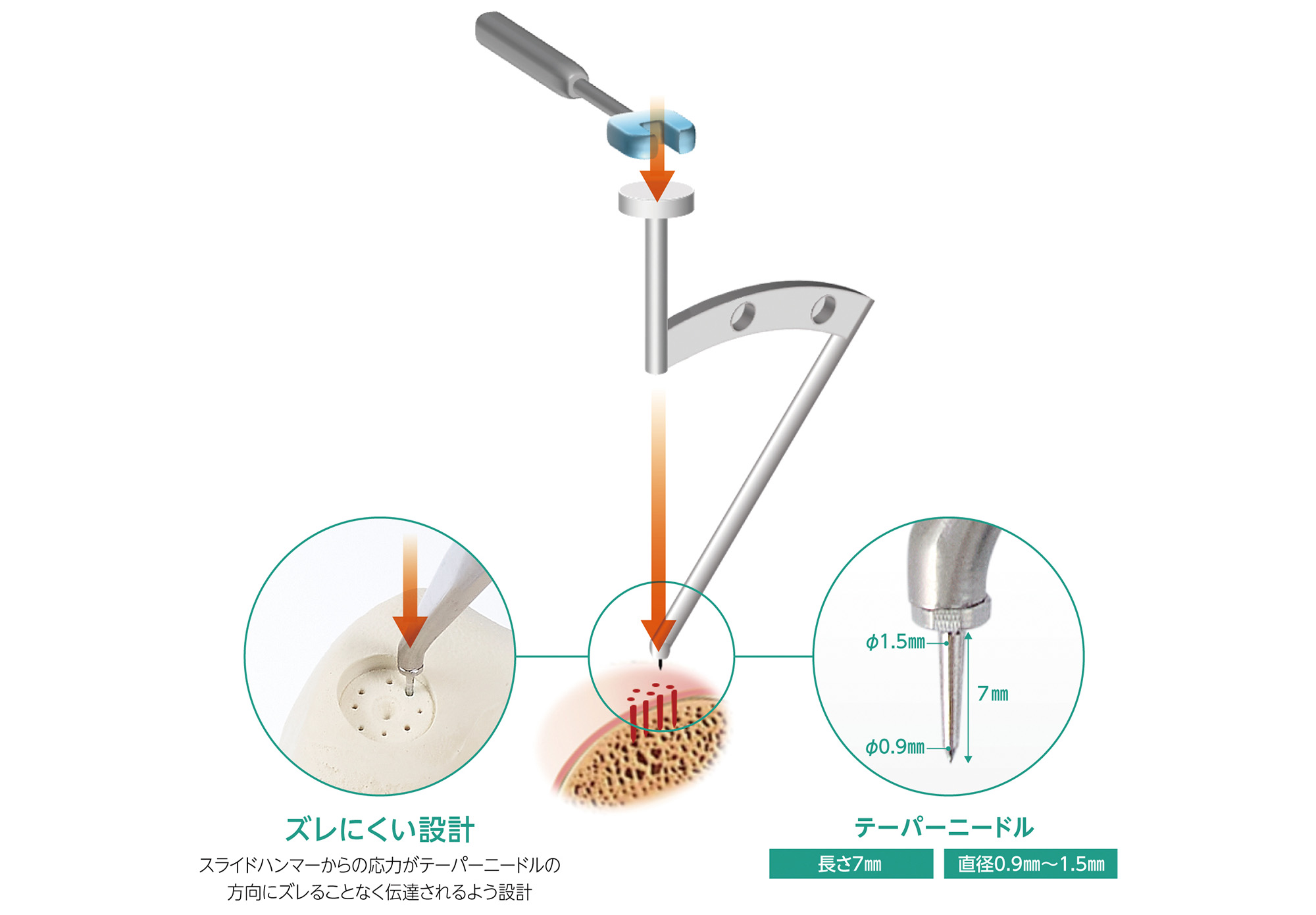 マイクロロータス<sup>🄬</sup>
